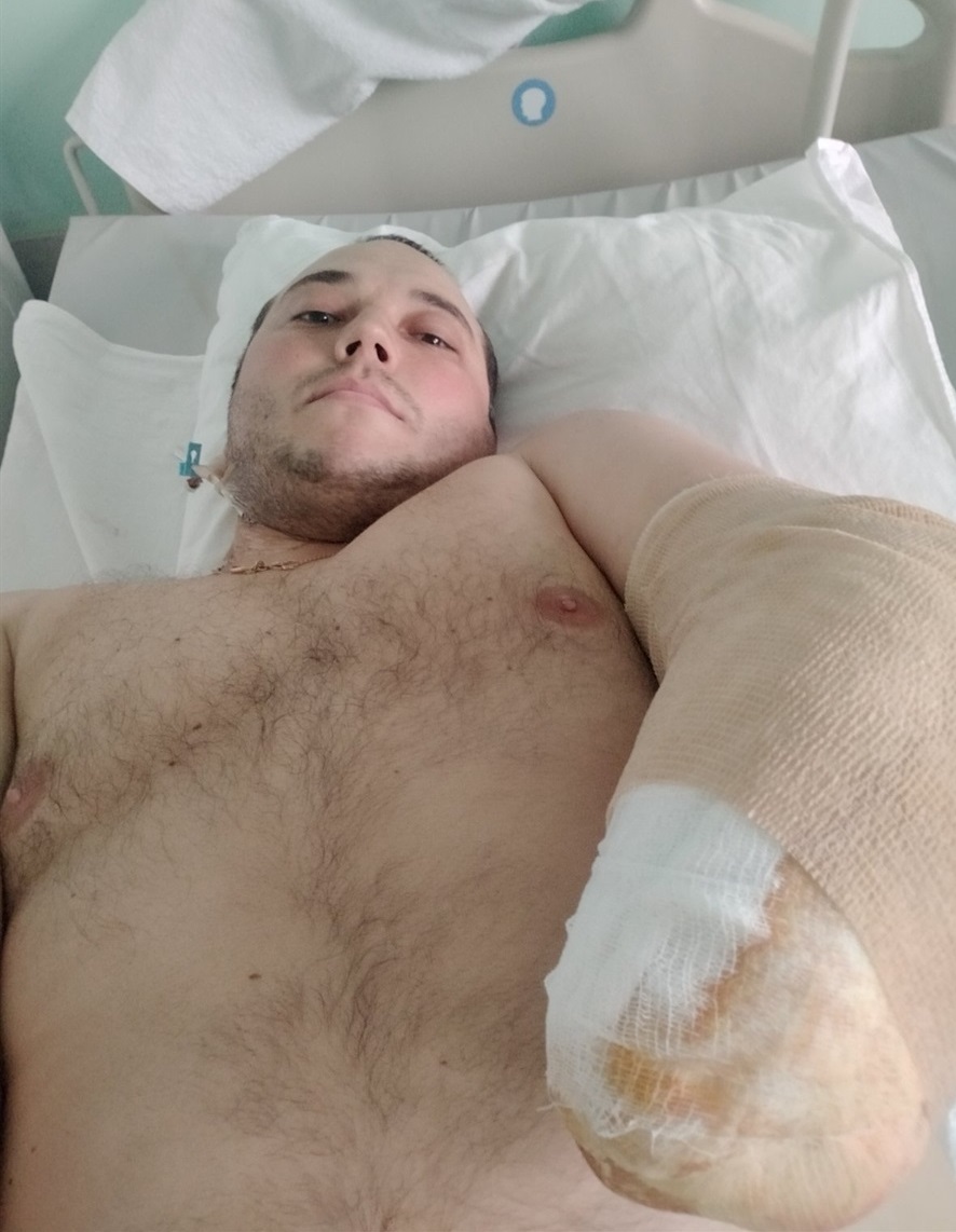 В госпіталі після поранення