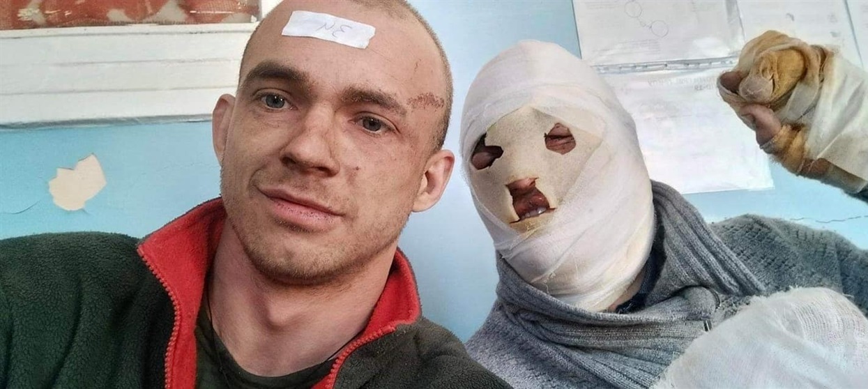 Максим Чечик - праворуч, друге поранення